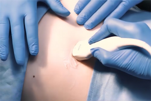 順產(chǎn)怕疼痛？產(chǎn)道干澀？試試助產(chǎn)寶的'順滑'助力！—平創(chuàng)醫(yī)療